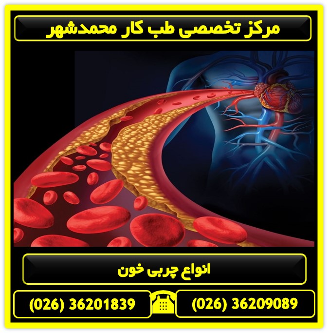 انواع چربی خون