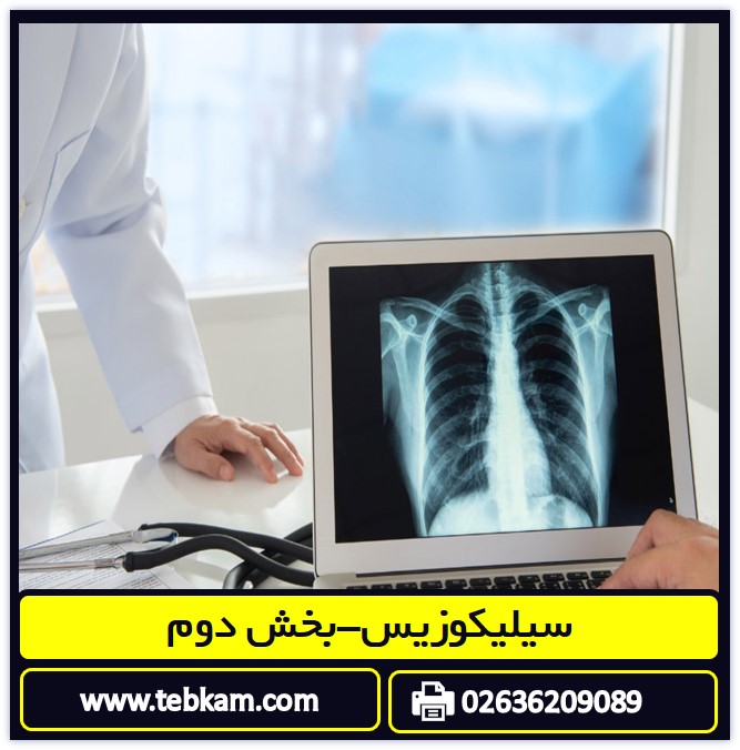 سیلیکوزیس-بخش دوم